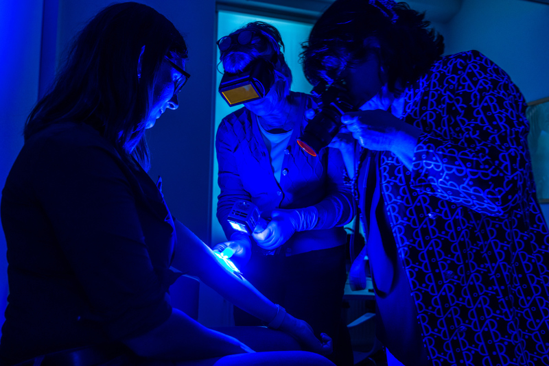 Forensisch artsen bekijken onderhuidse blauwe plekken met speciale blauwe lamp